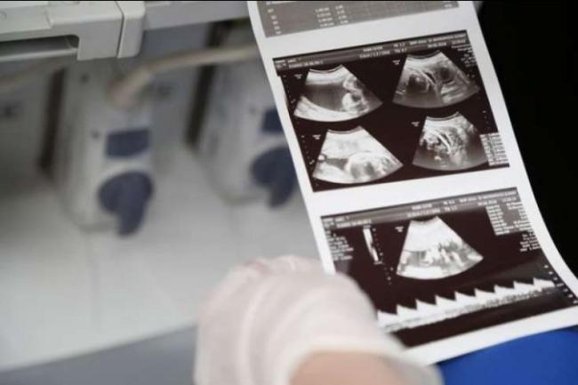 Bakıda özəl klinikada bakirə qızı nişanlısının yanında... Xəbər şəkili