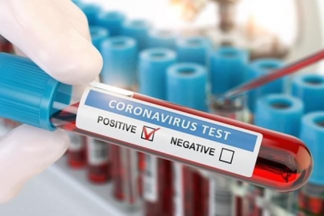 Klinikalar koronavirus testi müayinÉ™lÉ™rini dayandırdı XÉ™bÉ™r şəkili