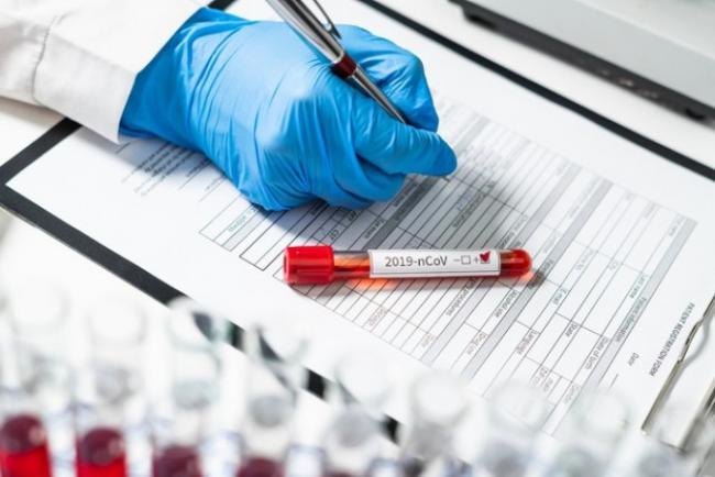 Deputatların növbəti koronavirus testinin nəticəsi açıqlandı Xəbər şəkili